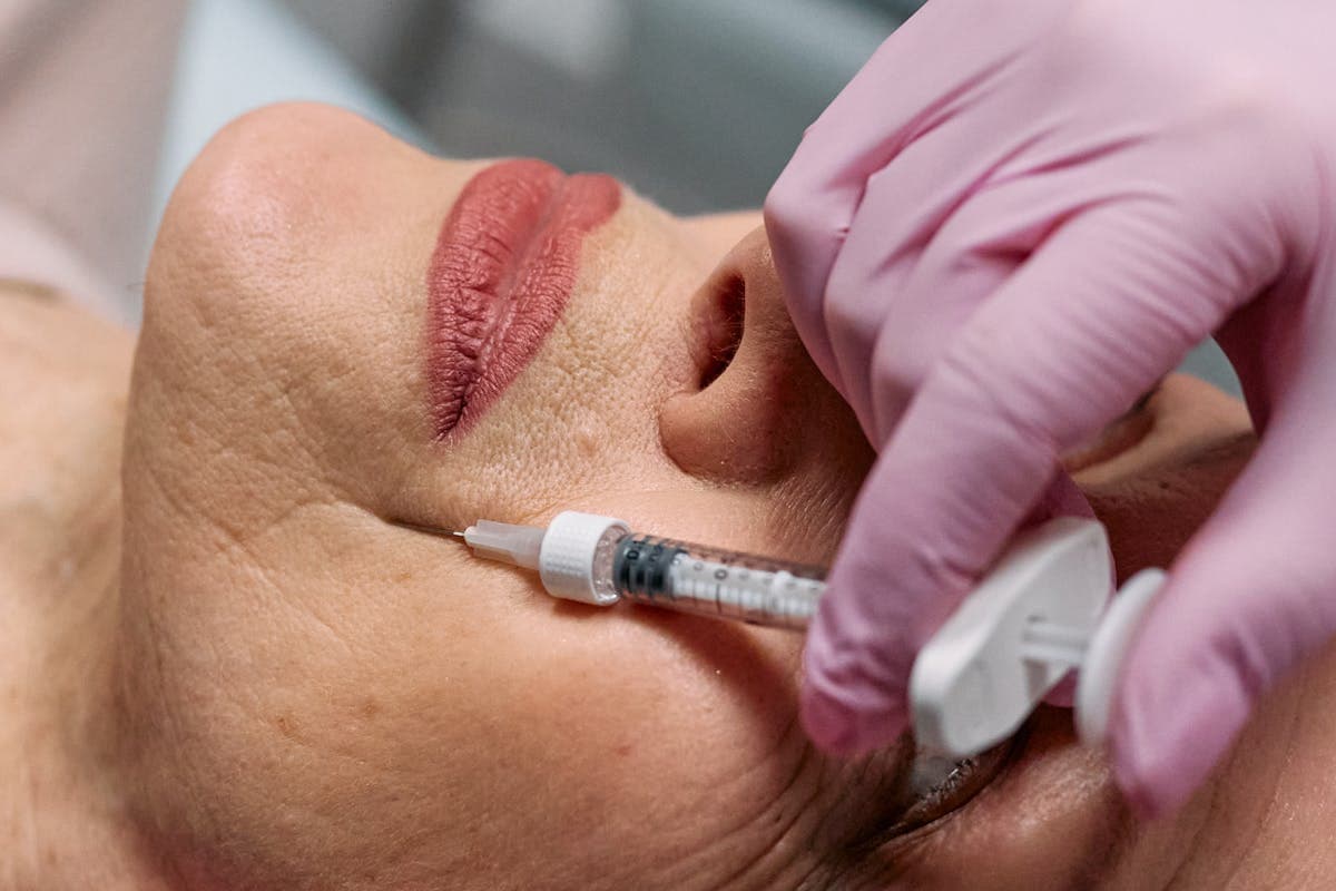 Dermal Filler Aftercare: The Complete Guide to Natural, Long-Lasting Results